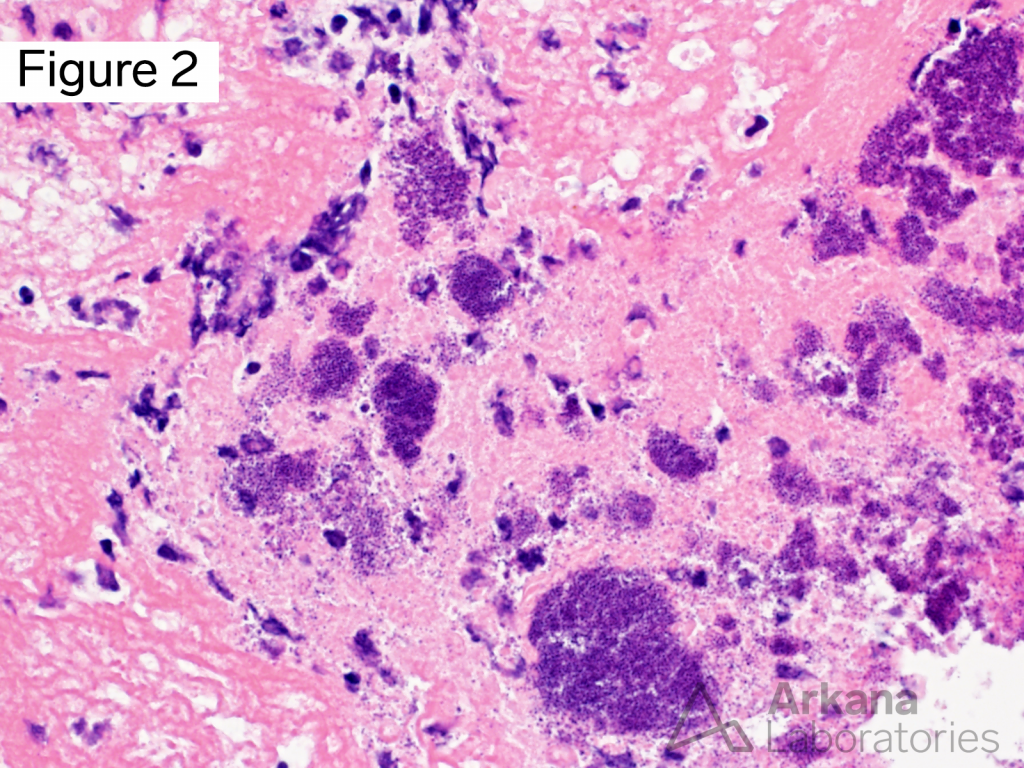 Tissue Gram Stain Neuro Notes Arkana Laboratories