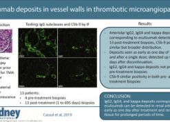 Eculizumab deposits in vessel walls in thrombotic microangiopathy