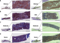 Trichrome-stained whole-slide images of human renal biopsies