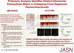 Proteomic Analysis Identifies Distinct Glomerular Extracellular Matrix in Collapsing Focal Segmental Glomerulosclerosis