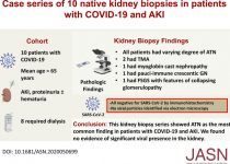 COVID-19-Associated Kidney Injury