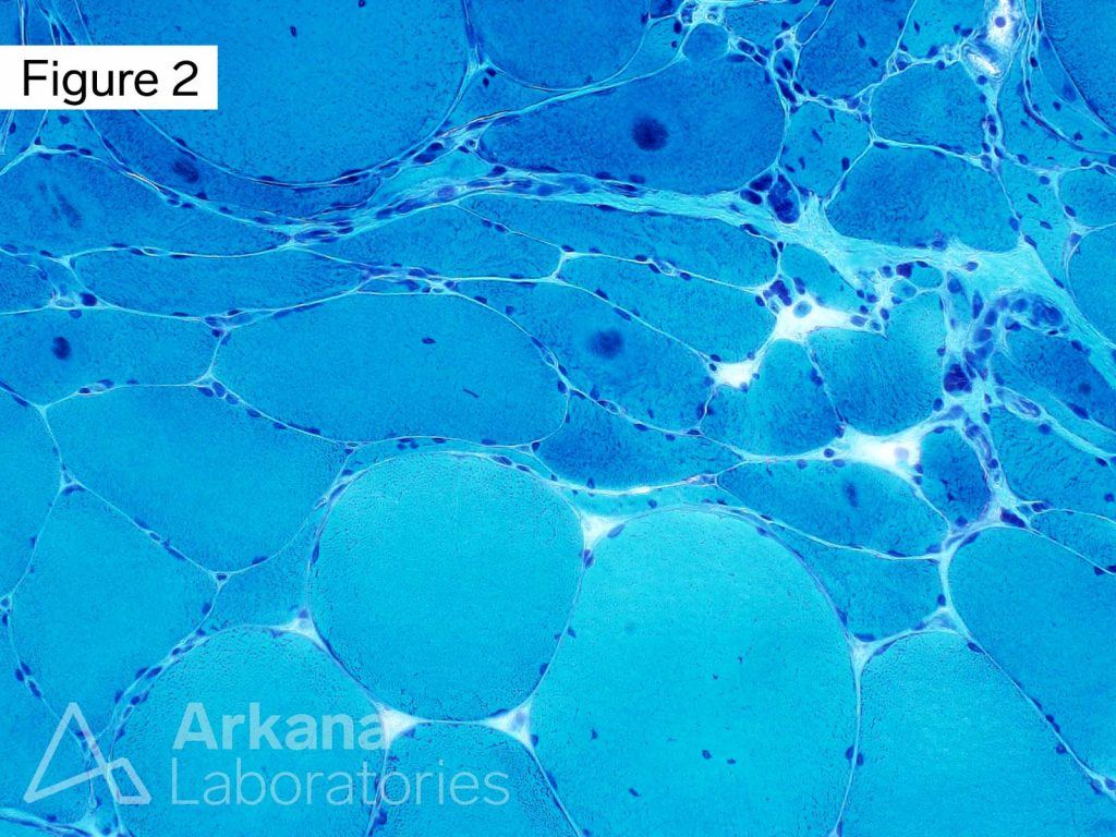 Target Fibers On Trichrome | Neuro Notes | Arkana Laboratories