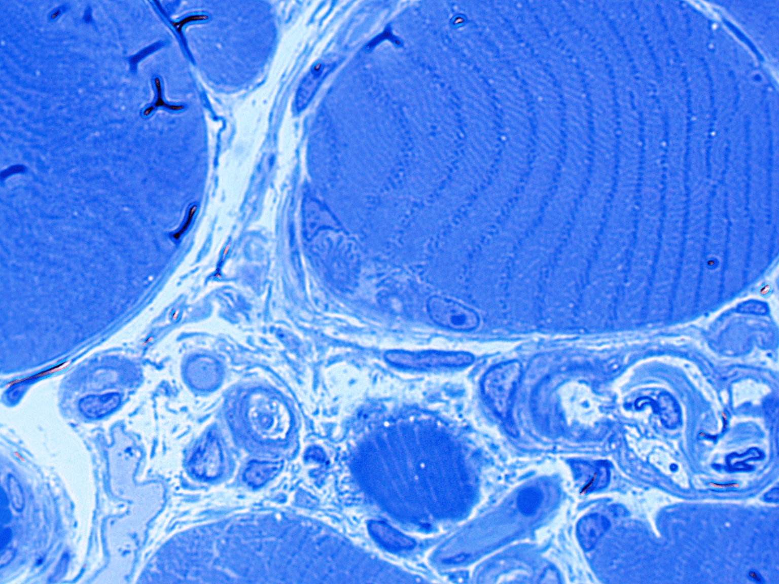 Neuromuscular Junction Thick Section | Neuro Notes