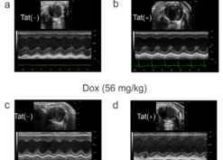 HIV-1 Tat Upregulates The Receptor For Advanced Glycation End Products And Superoxide Dismutase-2