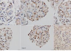 Proprotein convertase subtilisin kexin type 6