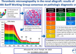 Thrombotic Microangiopathy in the Renal Allograft