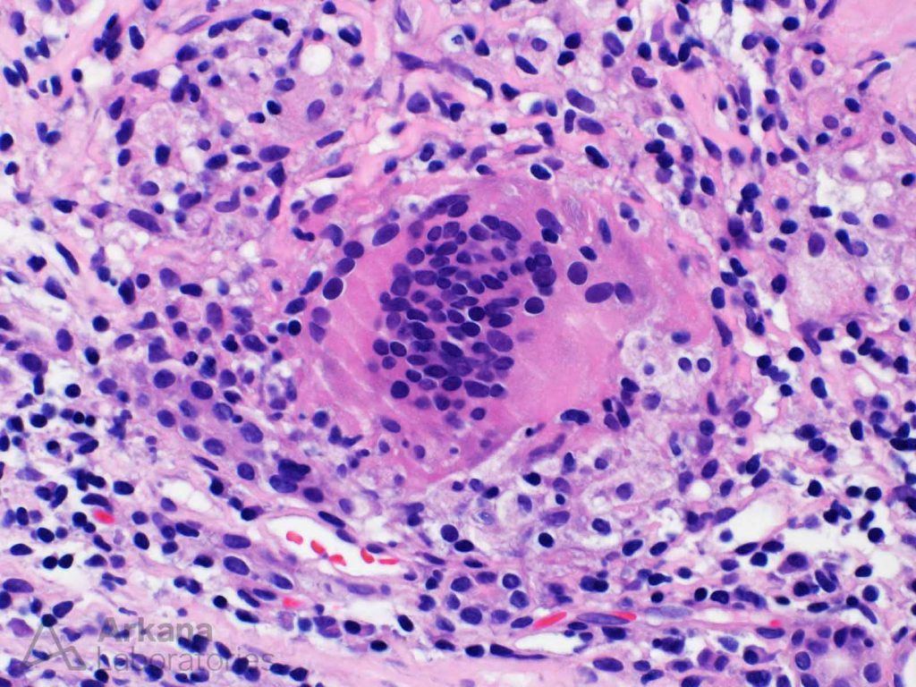 Giant Cells | Teaching Points | Arkana Laboratories