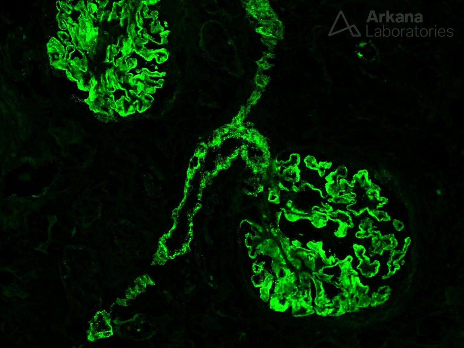 Vascular Staining in Membranous | Teaching Points | Arkana Laboratories