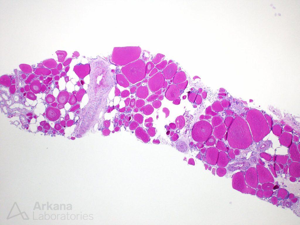 Thyroidization | Teaching Points | Arkana Laboratories